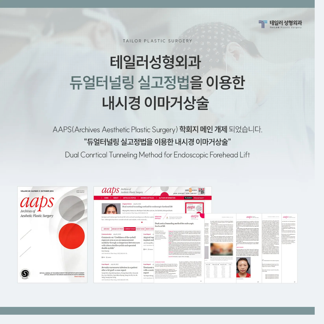 압구정 테일러 성형외과 듀얼터널링 실고정법 다중 고정 구조
