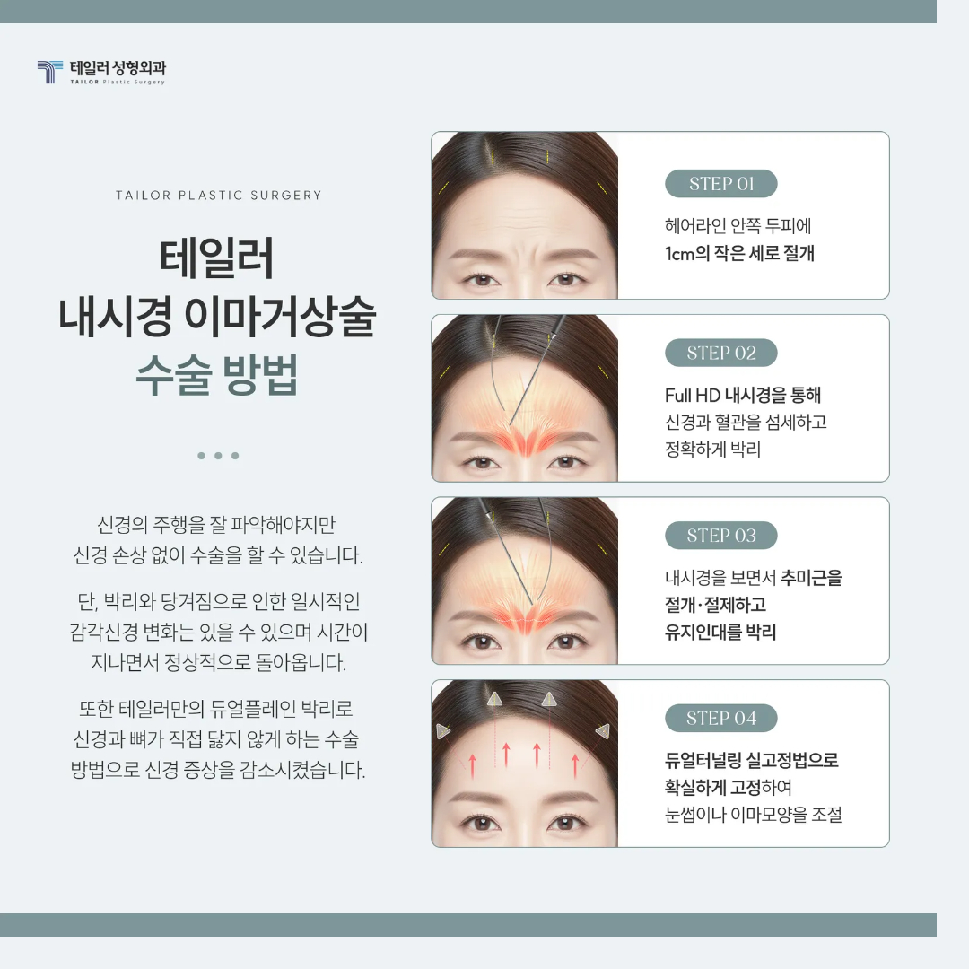 압구정 테일러 성형외과 내시경 이마거상술 수술 과정