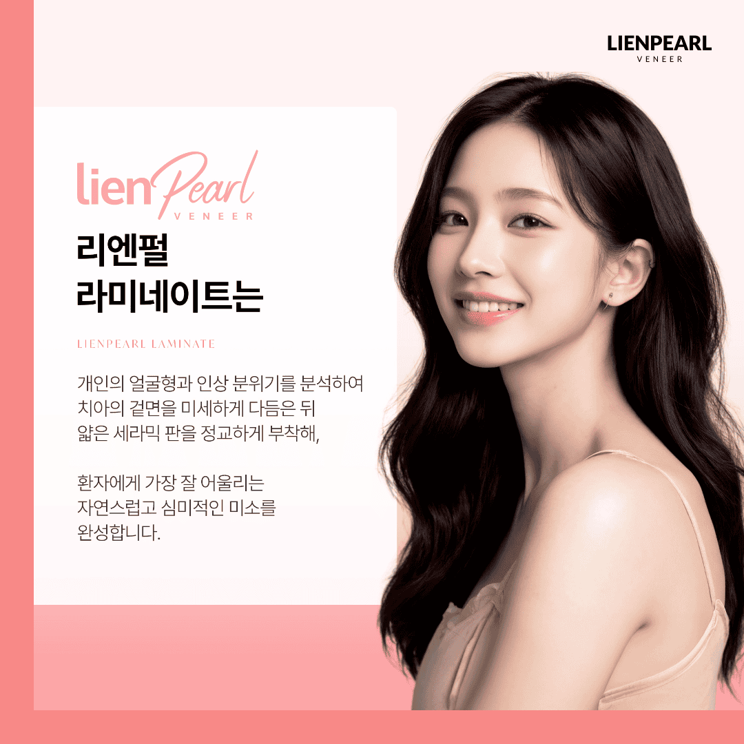 리엔장치과 리엔펄 라미네이트 시술 과정