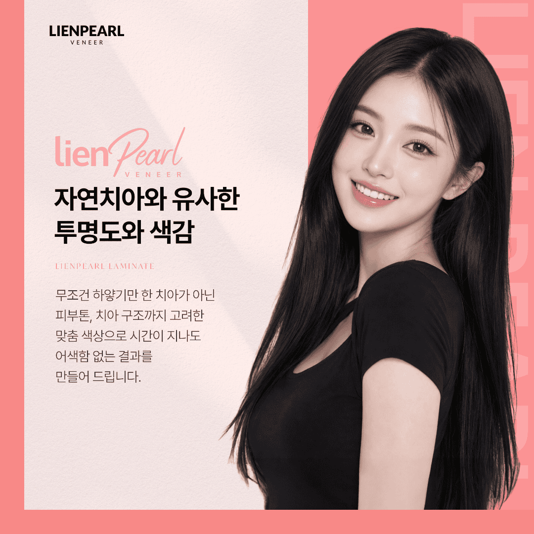 리엔장치과 라미네이트 색상 투명도
